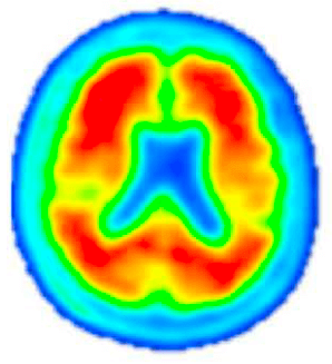 Pre-Investigational Treatment