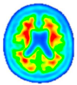 Post-Investigational Treatment